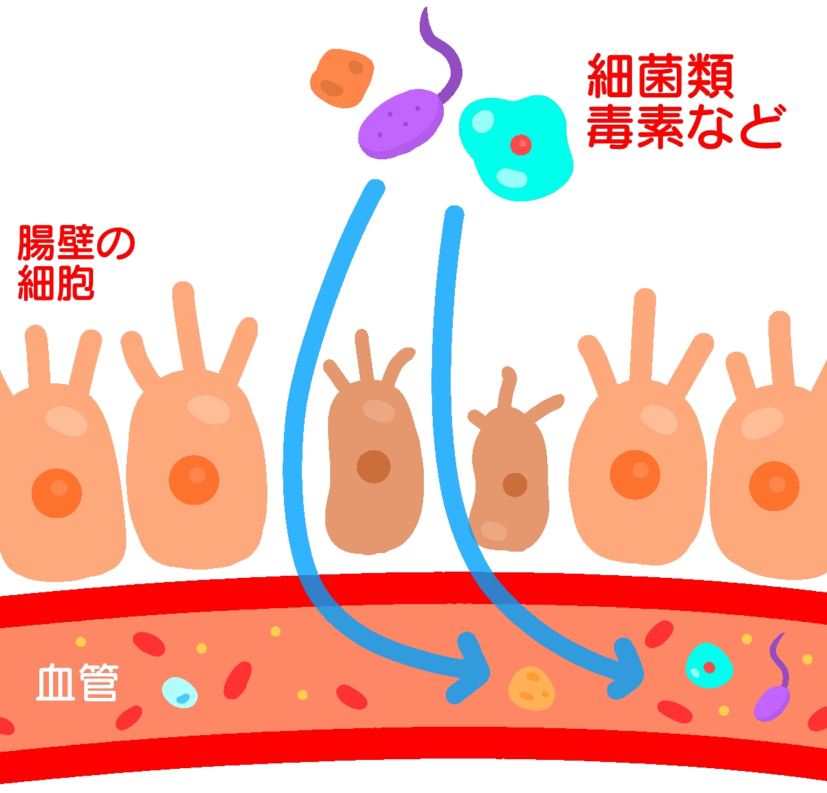 リーキーガット症候群